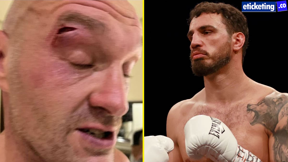 Fury Vs Usyk Tickets | Tyson Vs Usyk Tickets |